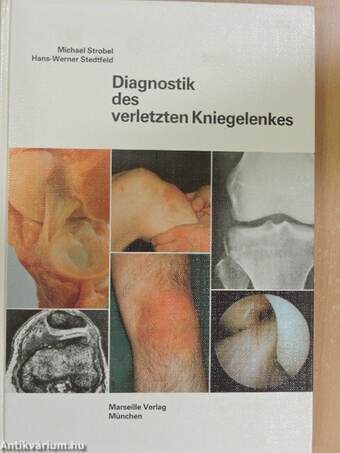 Diagnostik des verletzten Kniegelenkes