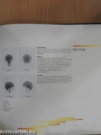 The clinical application of rCBF imaging by SPET