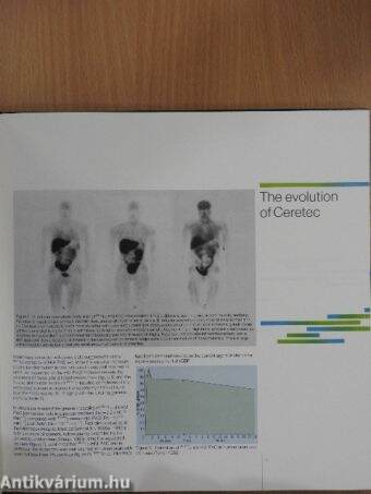 The clinical application of rCBF imaging by SPET