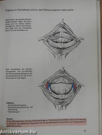 Zugangswege in der Traumatologie