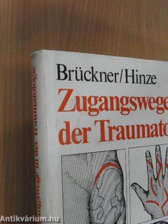 Zugangswege in der Traumatologie