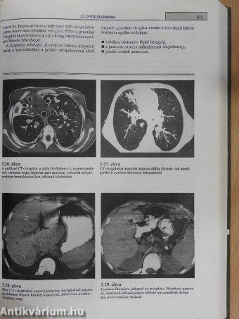 Pulmonológia