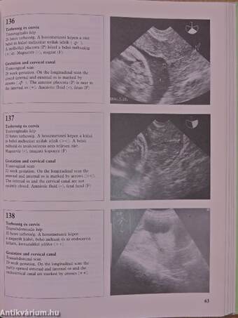 Szülészeti-nőgyógyászati ultrahang-diagnosztika Atlasz