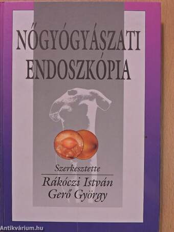 Nőgyógyászati endoszkópia