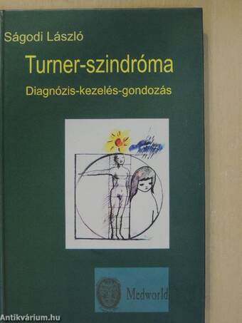 Turner-szindróma