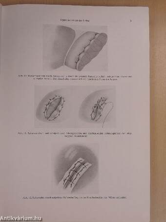 Chirurgische Operationslehre 4/II.