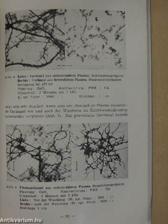 Progress in Nuclear Hematology and Allied Fields