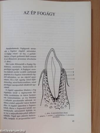 Parodontológia