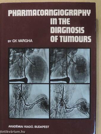 Pharmacoangiography in the Diagnosis of Tumours