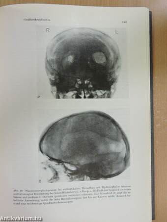 Neurologie und Psychiatrie sowie Grundzüge der Kinderneuropsychiatrie