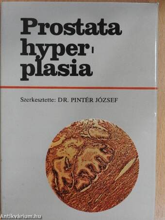 Prostata hyperplasia