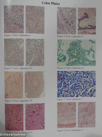 Review for USMLE Step 1