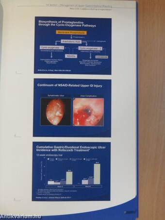 Defining the Matrix of the Mucosa