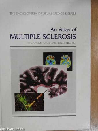 An Atlas of Multiple Sclerosis