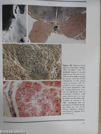 An Atlas of Multiple Sclerosis