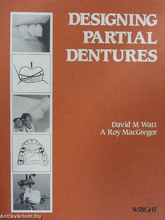 Designing Partial Dentures