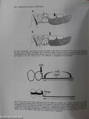 Designing Partial Dentures