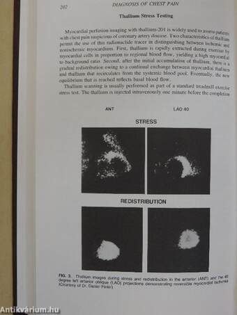 Diagnosis of Chest Pain