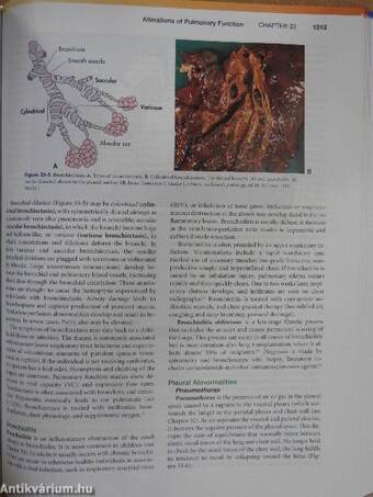 Pathophysiology - CD-vel