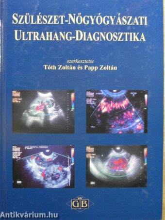 Szülészet-nőgyógyászati ultrahang-diagnosztika
