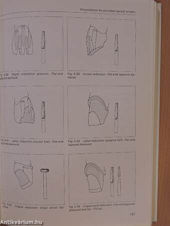 Fundamentals of Fixed Prosthodontics