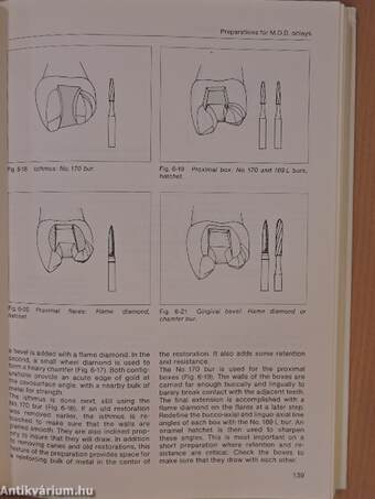 Fundamentals of Fixed Prosthodontics