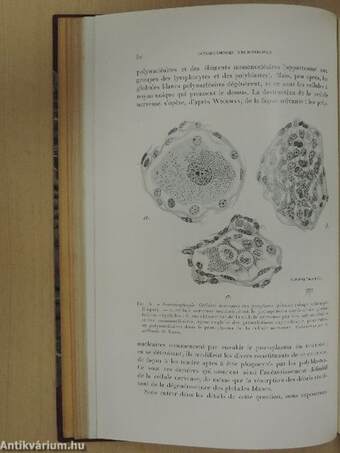 Ectodermoses neurotropes poliomyélite encéphalite herpés