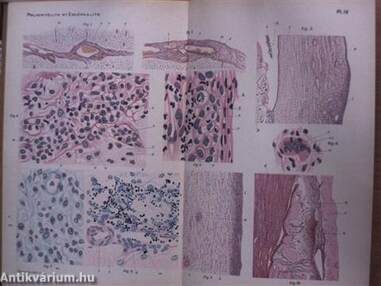 Ectodermoses neurotropes poliomyélite encéphalite herpés