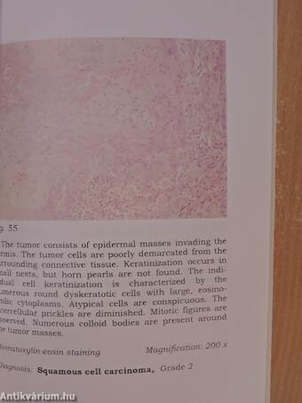 Atlas of Malignant Skin Tumors and their Therapy