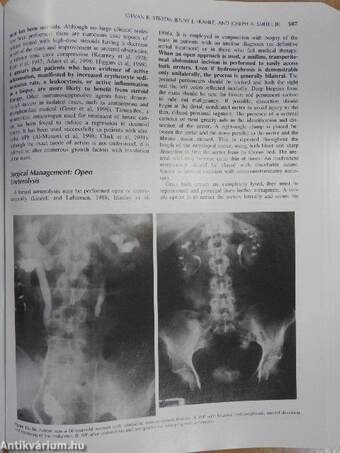 Campbell's Urology 1-4.