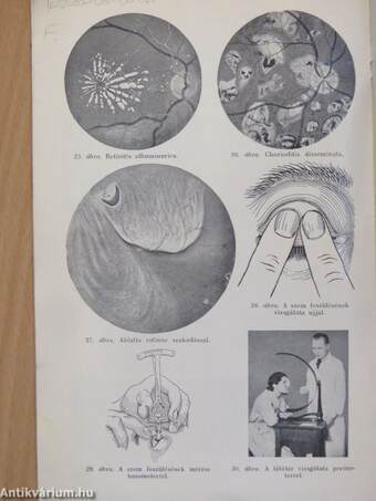 A szembetegségek diagnosztikája