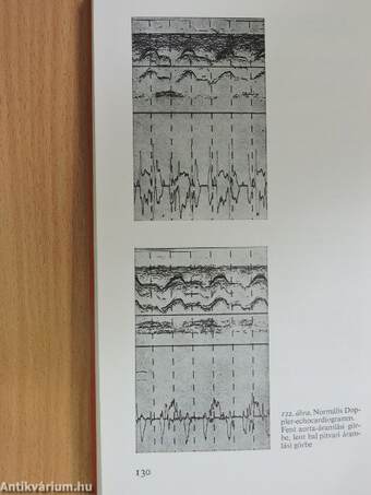 Echocardiographia