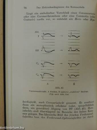 Vademecum der klinischen Elektrokardiographie