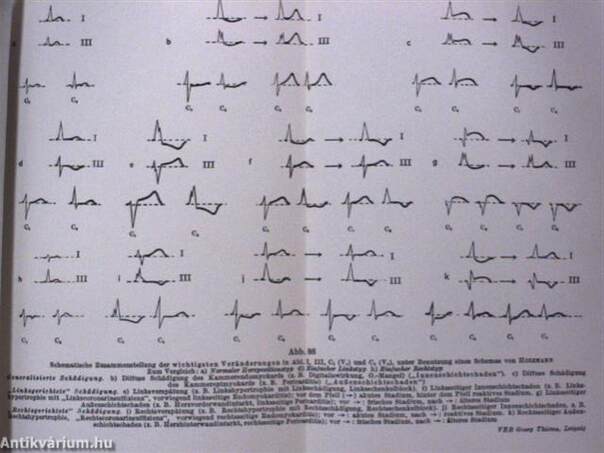 Vademecum der klinischen Elektrokardiographie