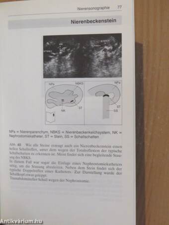 Urologische Sonographie