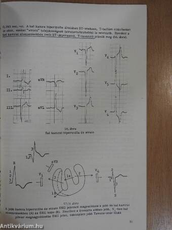 EKG-alapismeretek