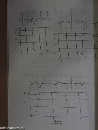 EKG-alapismeretek