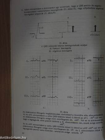 EKG-alapismeretek