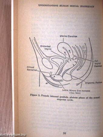 Understanding Human Sexual Inadequacy