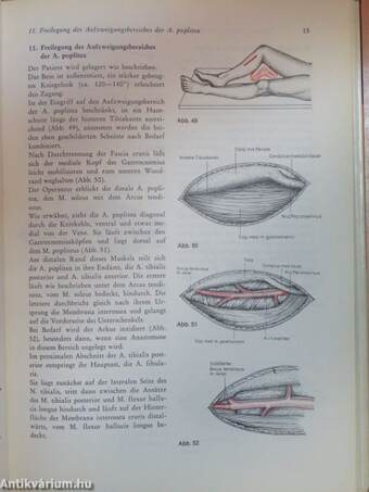 Manual der peripheren Arterienoperationen