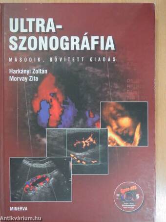 Ultraszonográfia - DVD-vel