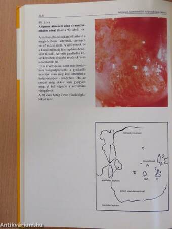 A kolposzkópia atlasza