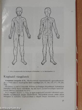 Csecsemő- és gyermekneurológia