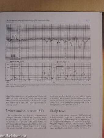 Az intrauterin magzat