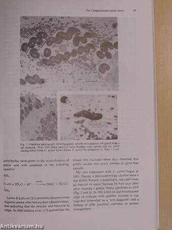 Acid-Related Disorders: A Decade after the Introduction of H2-Receptor Antagonists