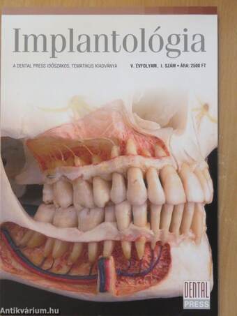Implantológia 2008/1.
