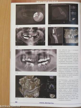 Implantológia 2008/1.