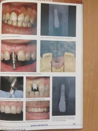 Implantológia 2008/1.