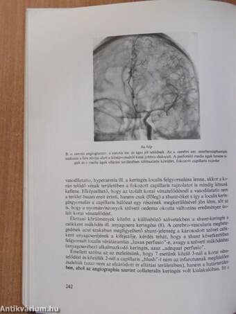 Magyar Radiologia 1978/1.