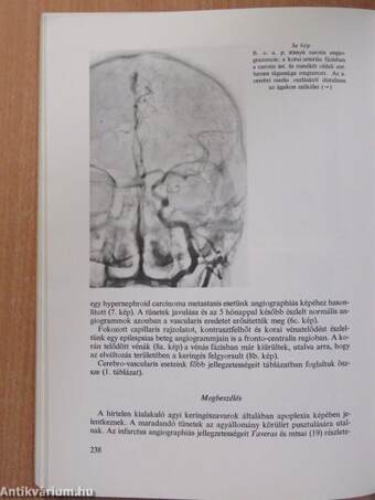 Magyar Radiologia 1978/1.